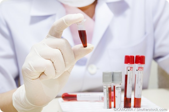 blood sample analysis